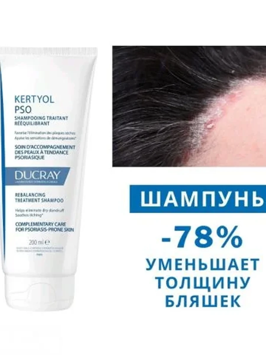 Ducray Kertyol PSO Шампунь лечебный при псориазе 200мл