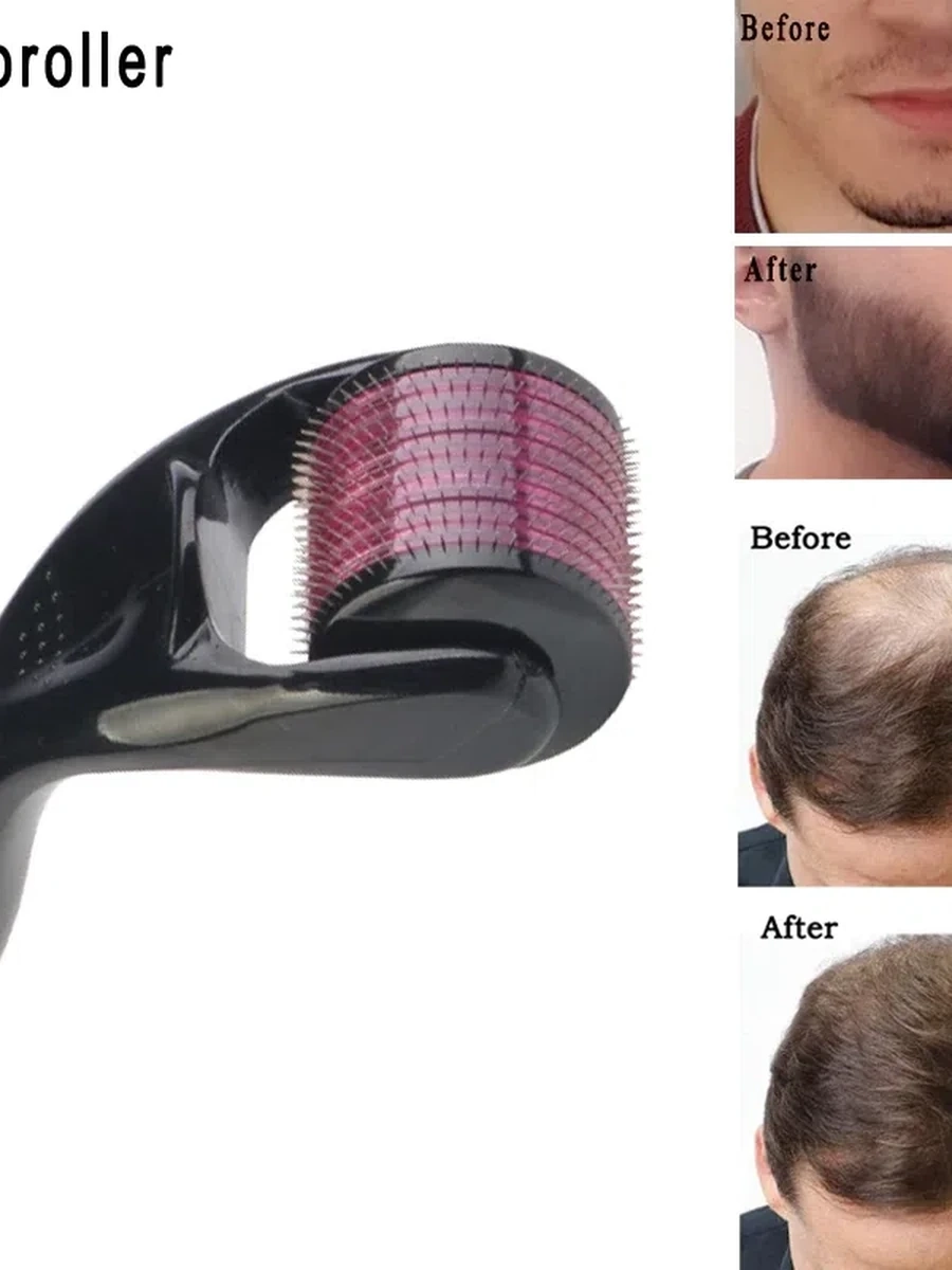 Ролик для роста бороды (мезороллер)