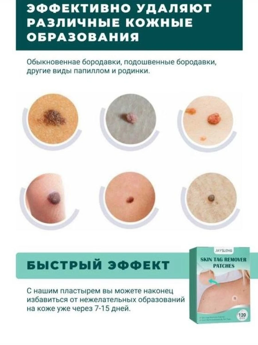 Пластырь от папиллом и бородавок / Точечные наклейки от прыщей и тегов